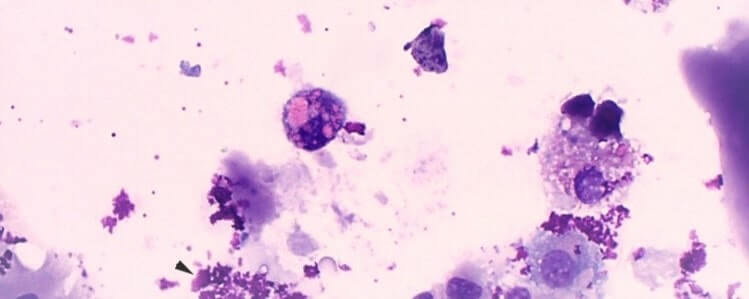 マクロファージ細胞の写真